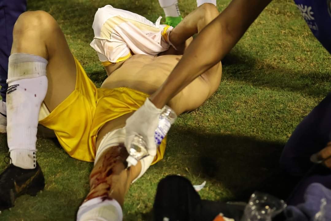 Policía le Disparó a un Jugador Tras Discusión en Brasil.