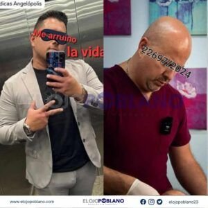 ¡CUIDADO! más Doctores charlatanes investigados por la Fiscalía de Puebla.