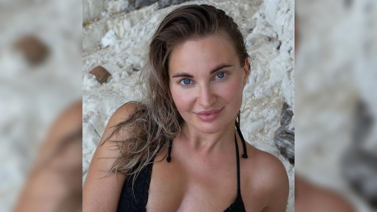 Influencer Muere en procedimiento para aumentar gluteos en Rusia.