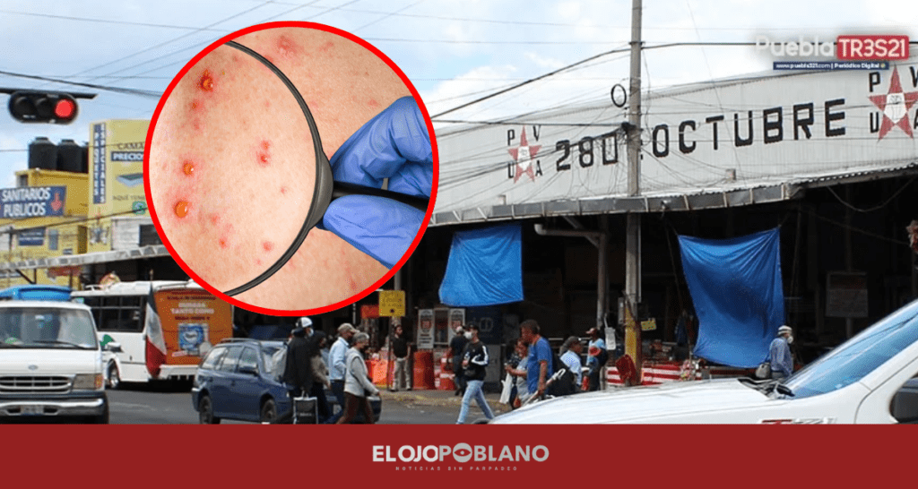 Jornada de Vacunación por brote de Sarampión en el Mercado Hidalgo