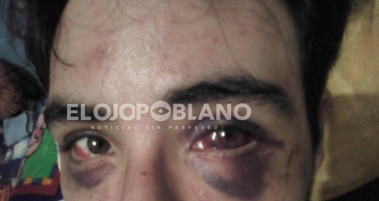 No mms, casi lo mata y ahora Pegasso pide dinero y terapias a su hijo