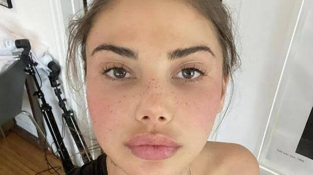 ¡Fentanilo! Droga mortal. De esto murió Sahara, ex de Justin Bieber